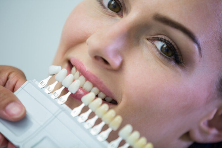 Implant dentar Pitesti
